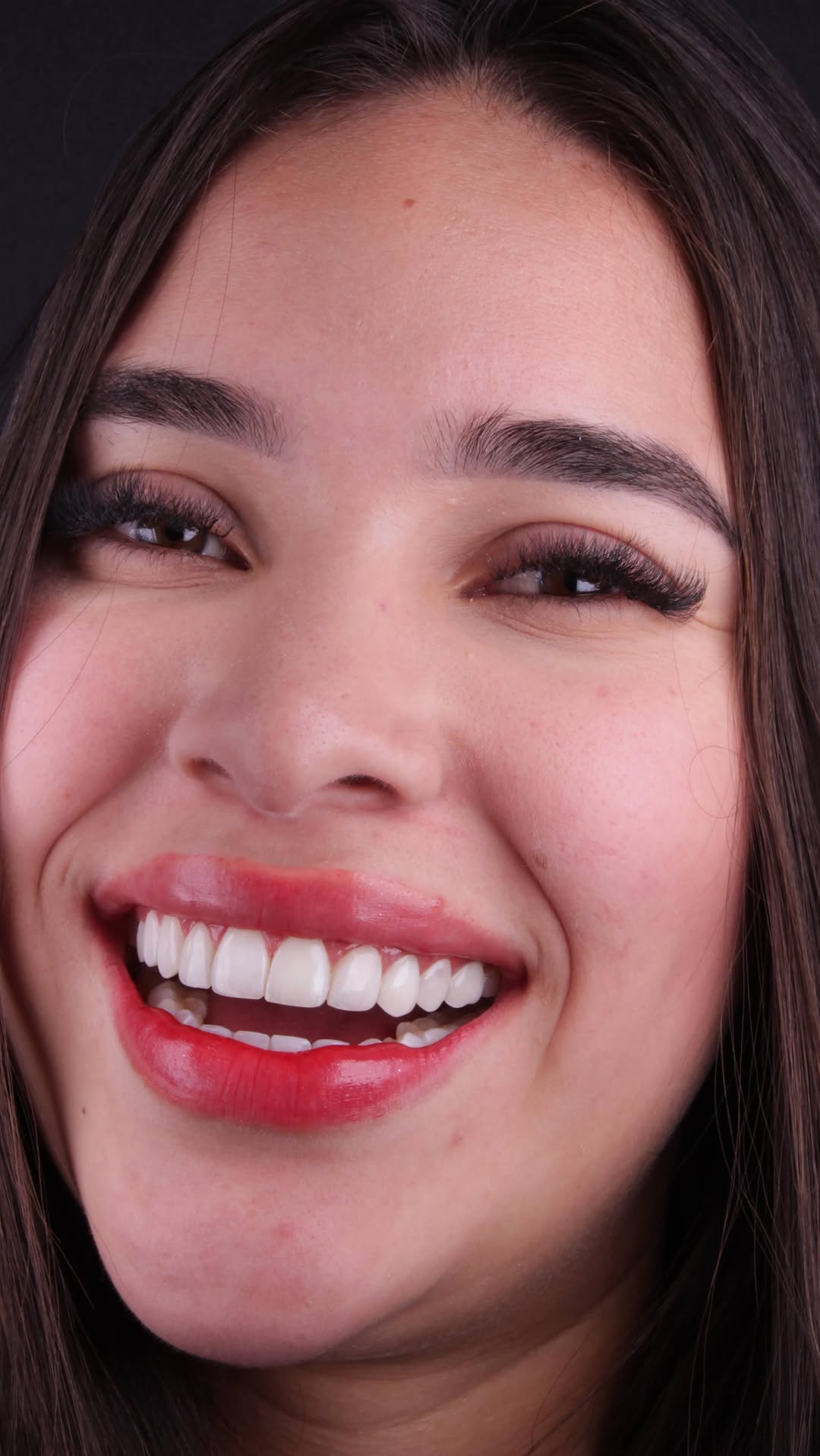 Sorriso com lente de contato dental e batom vermelho