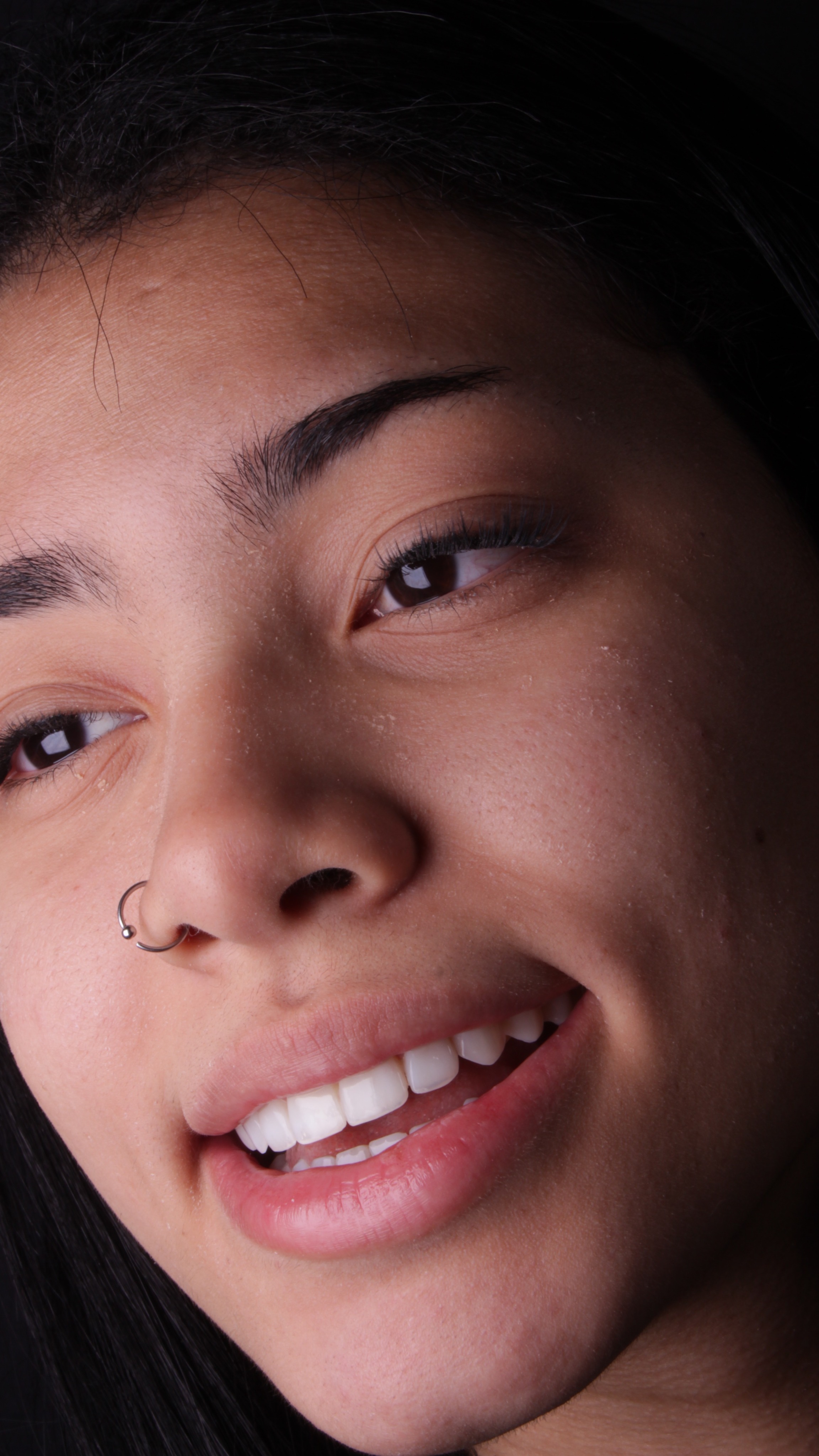 Sorriso com brilho natural — lente de contato dental