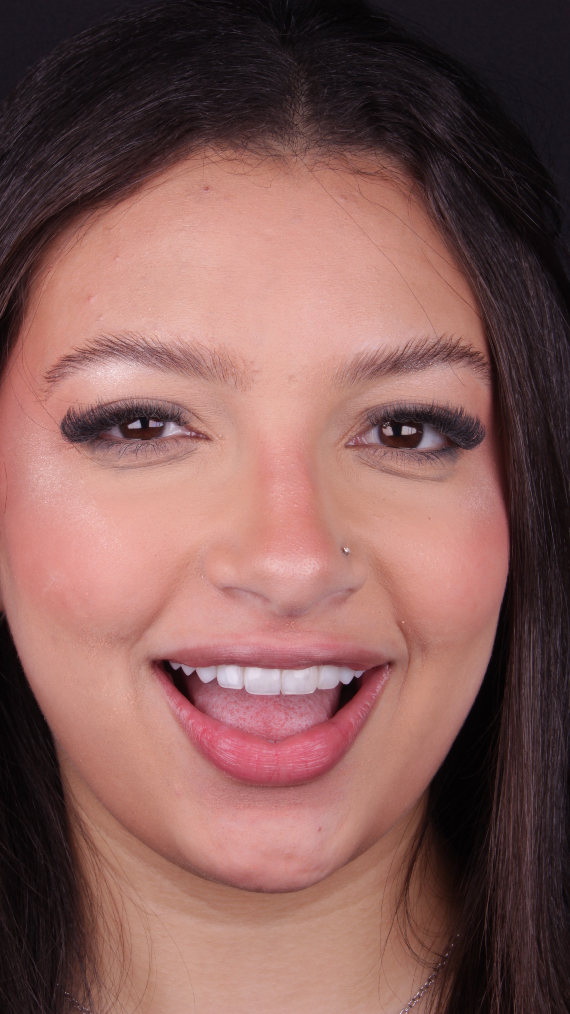 Sorriso com lente de contato dental, piercing no nariz